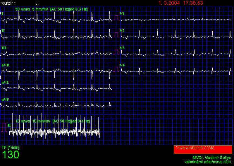 Fotky: Fibrilace s�n� (foto, obrazky)