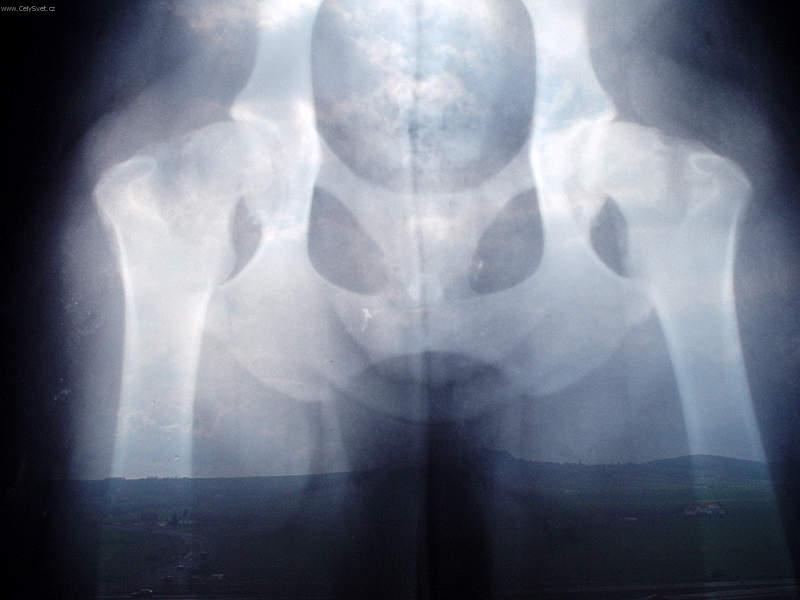 Foto: Ortopedie - DKK